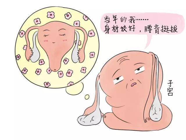 子宫脱垂的表现症状有哪些?