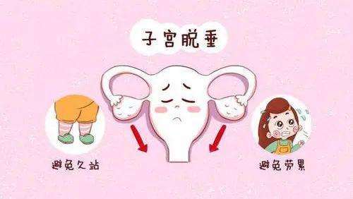 子宫脱垂预后措施子宫脱垂手术前后的护理措施